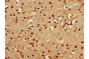 Immunohistochemistry of paraffin-embedded human brain tissue using ABIN7164089 at dilution of 1:100 (PRDM16 anticorps  (AA 448-683))