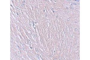 Immunohistochemical staining of human brain cells with SYNPO polyclonal antibody  at 2. (SYNPO anticorps  (C-Term))