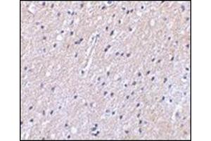 Immunohistochemical staining of human brain tissue using AP30592PU-N at 2. (SLC9A1 anticorps  (Center))