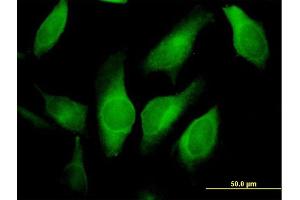 Immunofluorescence of purified MaxPab antibody to AMID on HeLa cell.