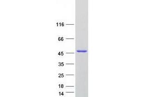 Validation with Western Blot
