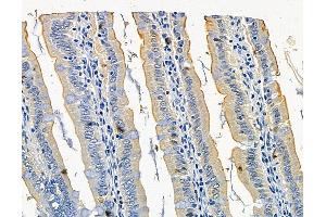 ABIN7096351 and ABIN7100413 at 1/100 staining rat colorectal tissue by IHC-P. (LIMS2 anticorps)