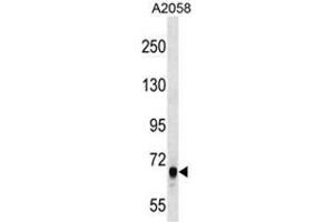 ARHGEF5 Antibody (C-term) western blot analysis in A2058 cell line lysates (35µg/lane). (ARHGEF5 anticorps  (C-Term))