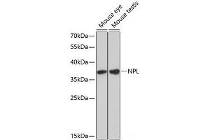 Western blot analysis of extracts of various cell lines using NPL Polyclonal Antibody at dilution of 1:3000. (NPL anticorps)