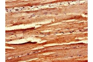 Immunohistochemistry of paraffin-embedded human skeletal muscle tissue using ABIN7159984 at dilution of 1:100