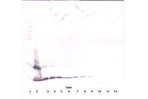 Image no. 2 for anti-PDGF-BB Homodimer antibody (ABIN465590) (PDGF-BB Homodimer anticorps)