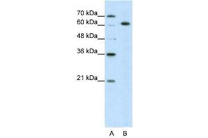 WB Suggested Anti-SNRP70  Antibody Titration: 5. (SNRNP70 anticorps  (N-Term))