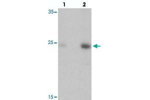 Western blot analysis of DRGX in rat liver tissue with DRGX polyclonal antibody  at (lane 1) 1 and (lane 2) 2 ug/mL.