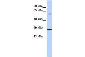 WB Suggested Anti-LPCAT1 Antibody Titration:  0. (LPCAT1 anticorps  (Middle Region))