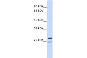REEP1 antibody used at 1 ug/ml to detect target protein.