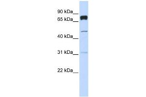 WB Suggested Anti-PLEKHA4 Antibody Titration:  0. (PLEKHA4 anticorps  (Middle Region))