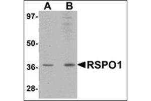Western blot analysis of RSPO1 in rat spleen tissue lysate with this product at (A) 1 and (B) 2 μg/ml. (RSPO1 anticorps  (N-Term))