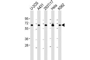 All lanes : Anti-RSL1D1 Antibody (C-Term) at 1:2000 dilution Lane 1: U-2OS whole cell lysate Lane 2: A431 whole cell lysate Lane 3: 293T/17 whole cell lysate Lane 4: Hela whole cell lysate Lane 5: K562 whole cell lysate Lysates/proteins at 20 μg per lane. (RSL1D1 anticorps  (AA 455-485))