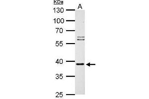 WB Image SAE1 antibody detects SAE1 protein by Western blot analysis. (SAE1 anticorps)