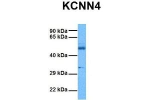 Host:  Rabbit  Target Name:  KCNN4  Sample Tissue:  Human Ovary Tumor  Antibody Dilution:  1. (KCNN4 anticorps  (C-Term))