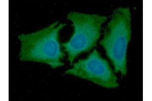 ICC/IF analysis of AK2 in HeLa cells line, stained with DAPI (Blue) for nucleus staining and monoclonal anti-human AK2 antibody (1:100) with goat anti-mouse IgG-Alexa fluor 488 conjugate (Green).