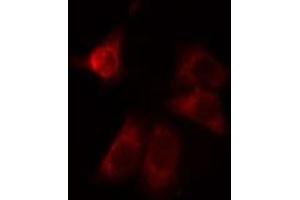 ABIN6275024 staining LOVO cells by IF/ICC. (CCDC102A anticorps  (Internal Region))
