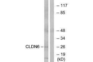 Western blot analysis of extracts from Jurkat cells, using CLDN6 antibody. (Claudin 6 anticorps  (Internal Region))