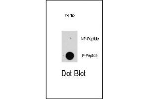 Dot blot analysis of anti-raptor-p Pab (R) on nitrocellulose membrane.