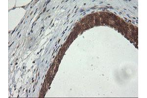 Image no. 6 for anti-Phosphoinositide-3-Kinase, Catalytic, gamma Polypeptide (PIK3CG) antibody (ABIN1500207)