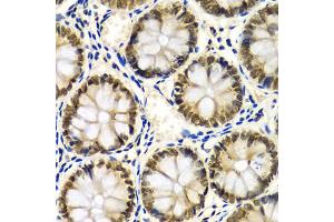 Immunohistochemistry of paraffin-embedded human colon using SNRPE Antibody (ABIN1876676) at dilution of 1:100 (40x lens). (SNRPE anticorps)