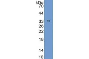 Rabbit Capture antibody from the kit in WB with Positive Control: Sample Human Skeletal muscle lysate. (Cardiac Troponin T2 Kit CLIA)
