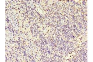 Immunohistochemistry of paraffin-embedded human tonsil tissue using ABIN7163557 at dilution of 1:100 (LCP1 anticorps  (AA 2-627))