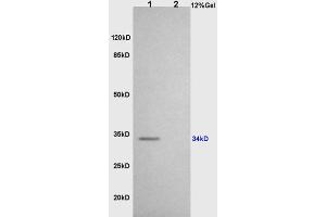 L1 rat brain lysates L2 rat heart lysates probed with Anti CD86/B7-2 Polyclonal Antibody, Unconjugated (ABIN736701) at 1:200 overnight at 4 °C.