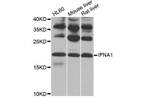 Western blot analysis of extracts of various cell lines, using IFNA1 antibody (ABIN5970112) at 1/1000 dilution. (IFNA1 anticorps)