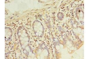 Immunohistochemistry of paraffin-embedded human small intestine tissue using ABIN7167776 at dilution of 1:100 (PDE6D anticorps  (AA 1-150))