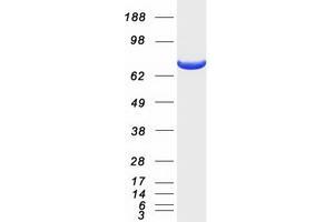 Validation with Western Blot