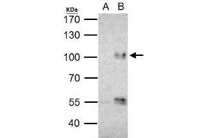 IP Image FOXO3A antibody immunoprecipitates FOXO3A protein in IP experiments. (FOXO3 anticorps  (C-Term))