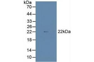 Detection of MAX in Porcine Heart Tissue using Polyclonal Antibody to MYC Associated Factor X (MAX)