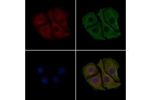ABIN6261244 and ABIN6279380 staining Hela cells by IF/ICC. (Dynactin 4 anticorps  (Internal Region))