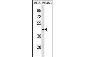 ALG8 Antibody (N-term) (ABIN1539057 and ABIN2850016) western blot analysis in MDA-M cell line lysates (35 μg/lane). (ALG8 anticorps  (N-Term))