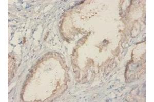 Immunohistochemistry of paraffin-embedded human prostate tissue using ABIN7142715 at dilution of 1:20