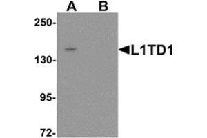 Western blot analysis of L1TD1 in Jurkat cell lysate with L1TD1 antibody at 1 ug/mL in (A) the absence and (B) the presence of blocking peptide. (L1TD1 anticorps  (C-Term))