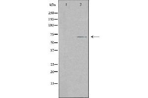 Western blot analysis of extracts from Jurkat cells, using SLC28A2 antibody. (SLC28A2 anticorps  (Internal Region))