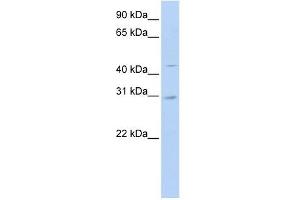 SLC10A4 antibody used at 1 ug/ml to detect target protein.
