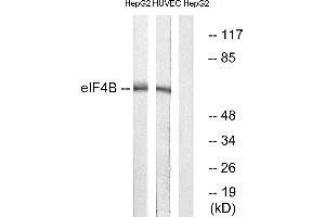 Immunohistochemistry analysis of paraffin-embedded human colon carcinoma tissue using eIF4B (Ab-422) antibody. (EIF4B anticorps)