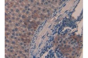 anti-Catalase (CAT) (AA 32-157) antibody