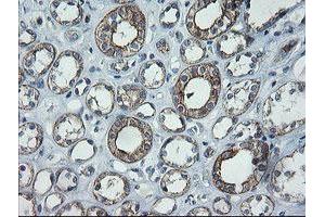 Image no. 4 for anti-Chromosome 2 Open Reading Frame 62 (C2orf62) antibody (ABIN1497054) (C2orf62 anticorps)