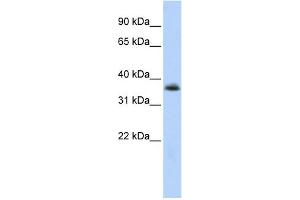 WB Suggested Anti-MNX1 Antibody Titration:  0. (MNX1 anticorps  (N-Term))
