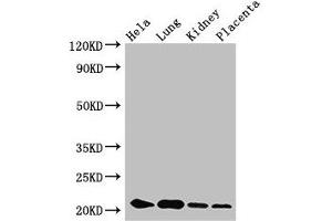 Western Blot Positive WB detected in: Hela whole cell lysate, Mouse lung tissue, Mouse kidney tissue, Human placenta tissue All lanes: KRBOX4 antibody at 3. (KRAB Box Domain Containing 4 (KRBOX4) (AA 1-98) anticorps)