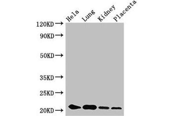 KRAB Box Domain Containing 4 (KRBOX4) (AA 1-98) 抗体