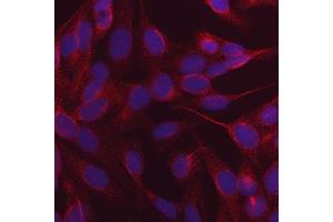 IF analysis of NDP52/CALCOCO2 using anti-NDP52/CALCOCO2 antibody (ABIN7599400). (CALCOCO2 anticorps  (AA 1-446))