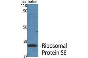 Western Blot (WB) analysis of specific cells using Ribosomal Protein S6 Polyclonal Antibody. (RPS6 anticorps  (Thr826))