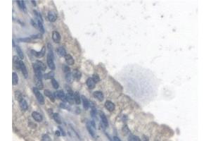 Detection of ARSA in Human Prostate Tissue using Polyclonal Antibody to Arylsulfatase A (ARSA) (Arylsulfatase A anticorps)