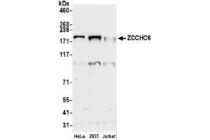 anti-Zinc Finger, CCHC Domain Containing 6 (ZCCHC6) (AA 800-850) antibody