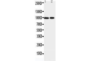 Western Blotting (WB) image for anti-erythrocyte Membrane Protein Band 4.1-Like 1 (EPB41L1) (AA 585-604), (C-Term) antibody (ABIN3042566) (EPB41L1 anticorps  (C-Term))